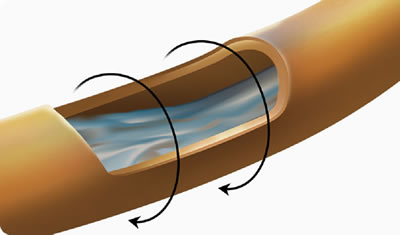 Enfriamiento CoreSculpt