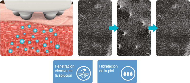 Sistema de electroporación de Hydratouch H2