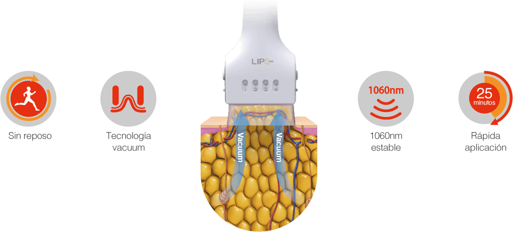 Tecnología láser y tecnología vacuum de LIPO1060