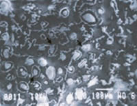 Reducción de grasa con Noble SHAPE