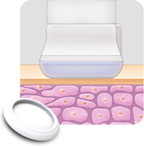 Liberación de iones de plasma Plapen dual