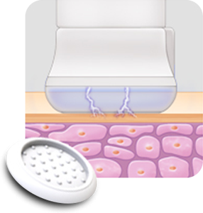 Liberación de iones Plapen dual