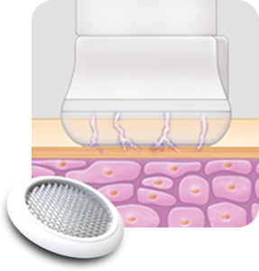 Tratamiento de frotación con plasma Plapen dual