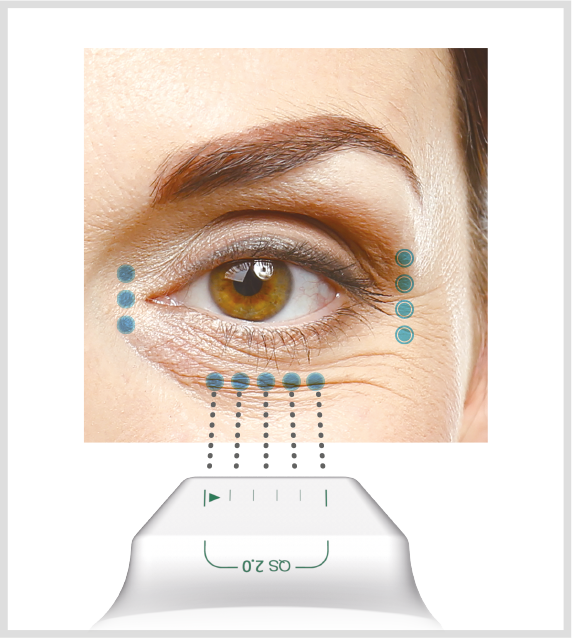 Mejor Accesibilidad con ULTRAcel Q+