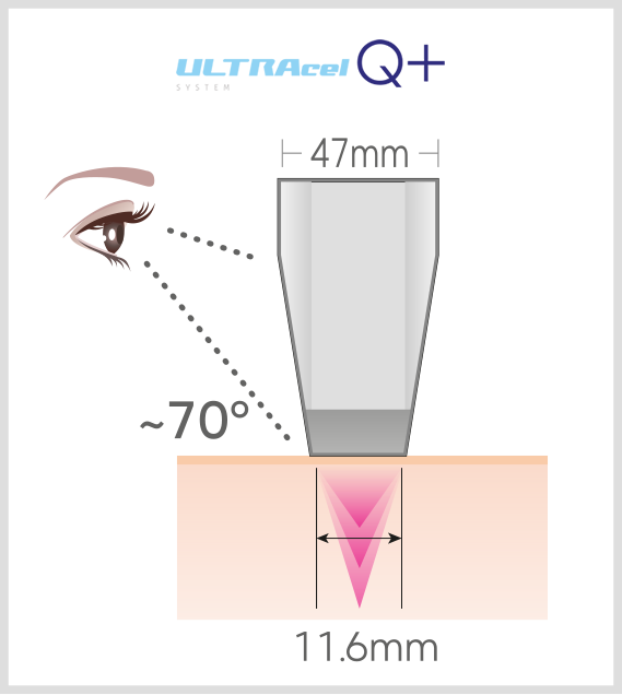 Visibilidad con ULTRAcel Q+