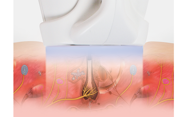 Enfrimiento de VeLux