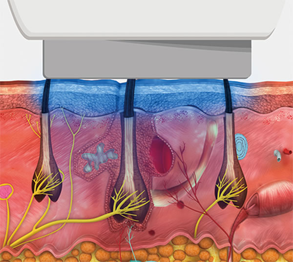 Sistema de enfriamiento de VeLux