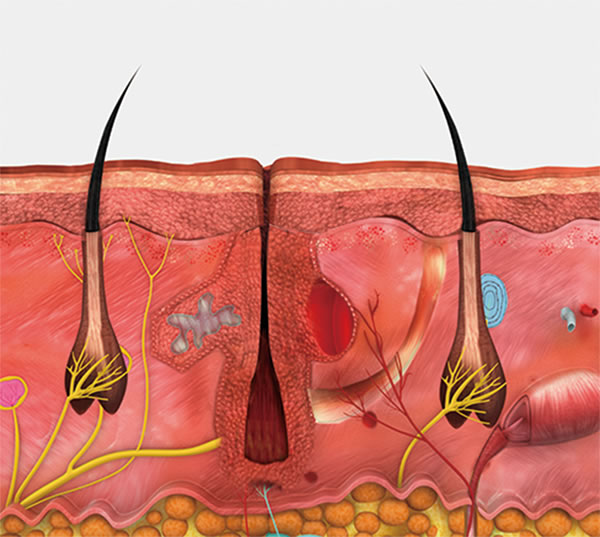 Depilación efectiva con VeLux 